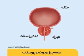 پروستات چیست عکس